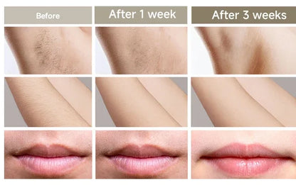 4-in-1 Laser Epilator Laser Hot Sell Permanent IPL Photoepilator Hair Removal Painless Electric Epilator Machine